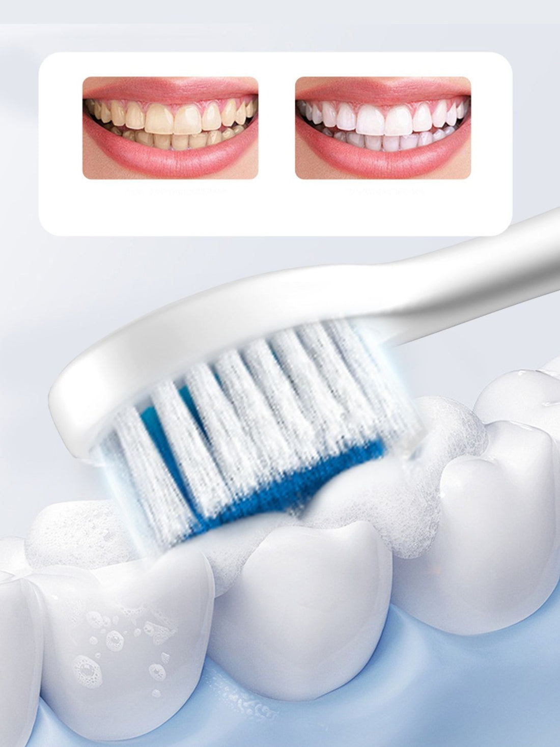 Dual Speed Waterproof Electric Toothbrush Set for Superior Clean - cas7m